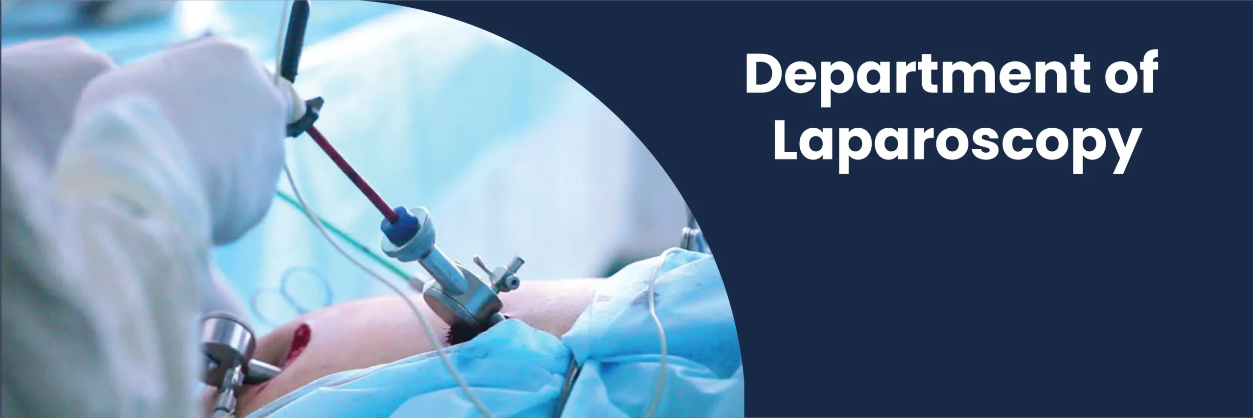 Department-Laproscopy