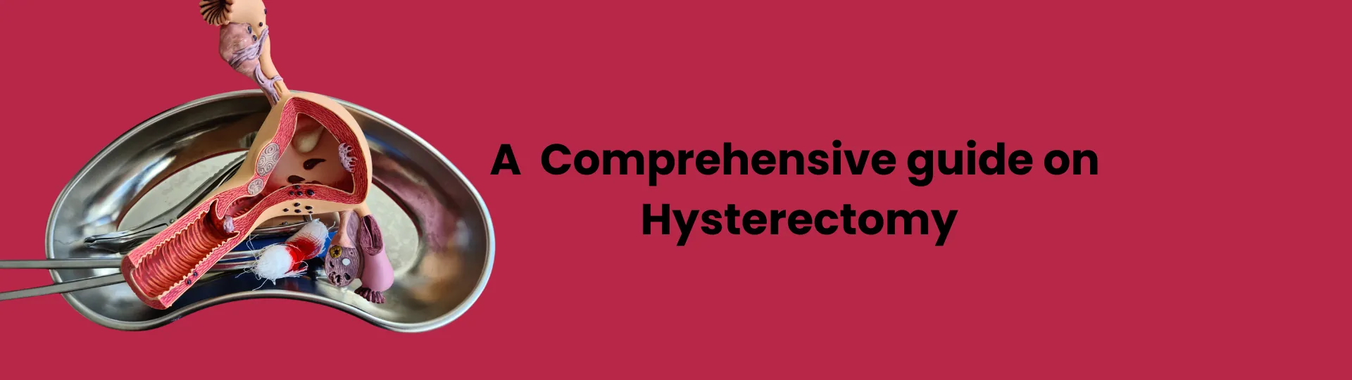 What is Hysterectomy surgery? Types of Hysterectomy & Alternatives