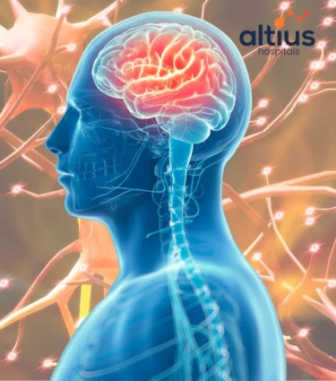 Best Neurologist in Bangalore